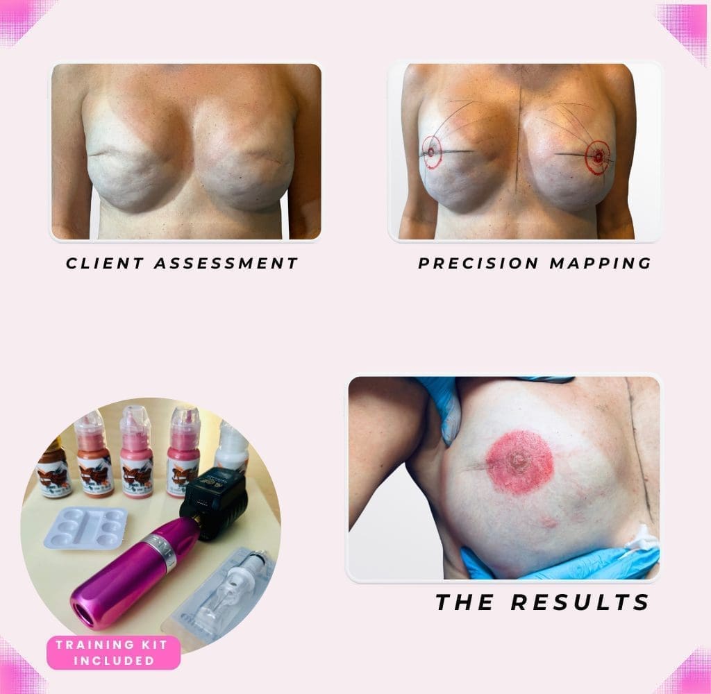 3D Areola training (non-graphic)